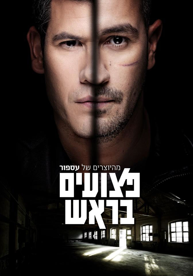 פצועים בראש - עונה 2, פרק 3